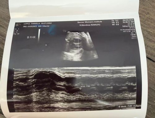A Positive Milestone: Daniella’s Baby Growth Ultrasound Shows Excellent Progress